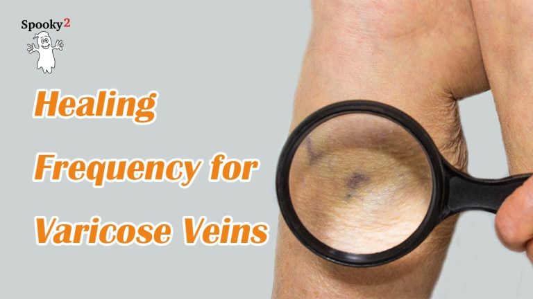 Varicose Veins Healing Frequency | Spooky2 Rife Frequencies