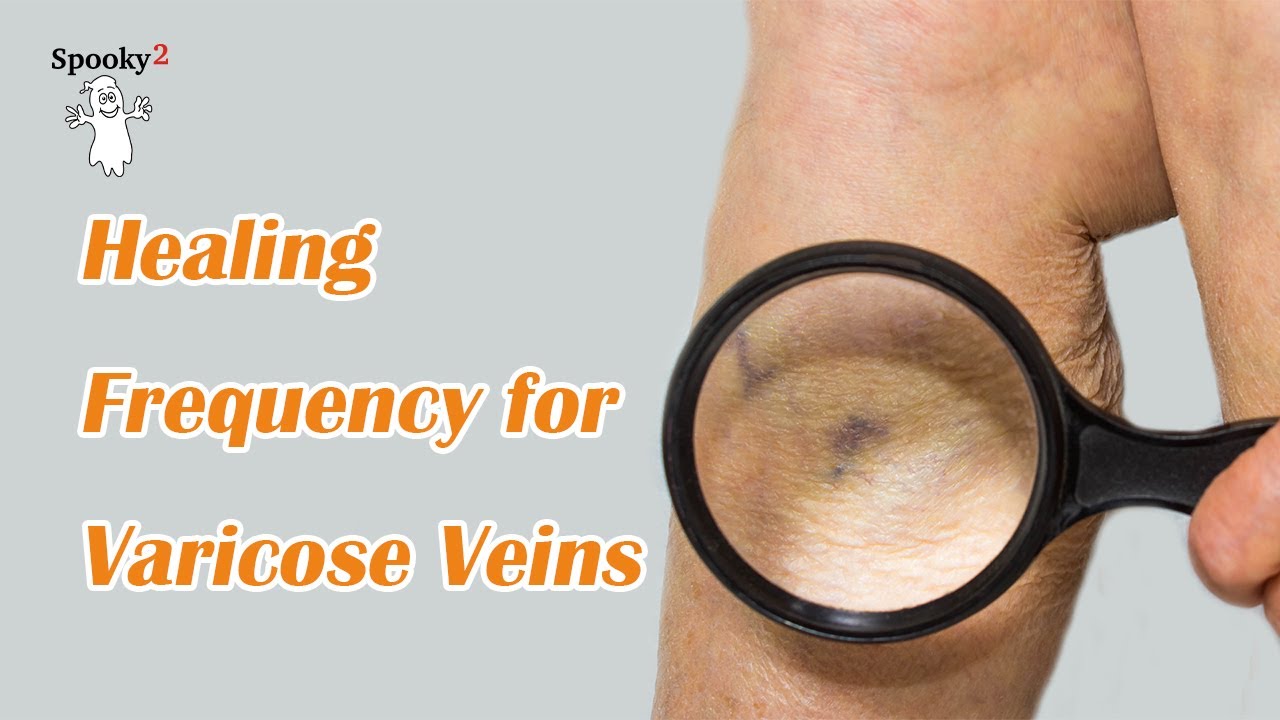 Varicose Veins Healing Frequency | Spooky2 Rife Frequencies