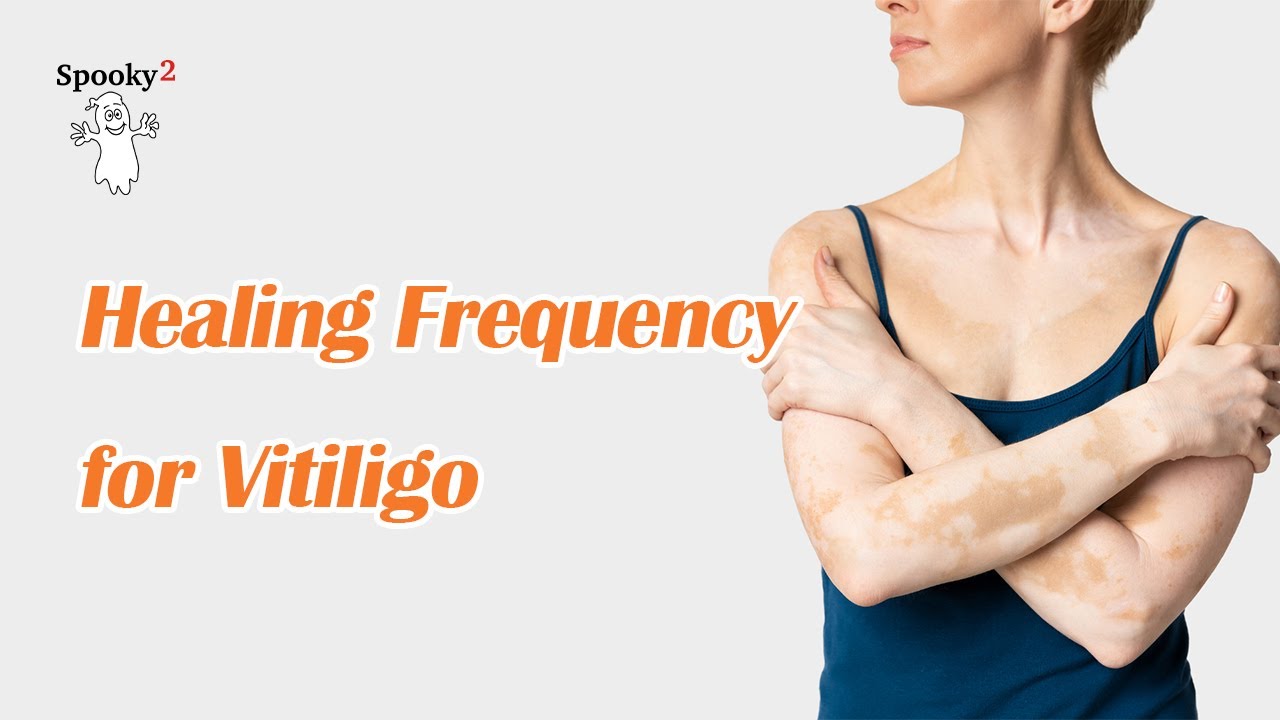 Vitiligo – Healing Frequency | Spooky2 Rife Frequencies